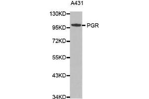 Western blot analysis of extracts of A431 cell lines, using PGR antibody. (Progesterone Receptor 抗体  (C-Term))