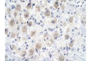 Rabbit Anti-YEATS4 antibody        Paraffin Embedded Tissue:  Human Brain cell   Cellular Data:  Epithelial cells of renal tubule  Antibody Concentration:   4. (GAS41 抗体  (Middle Region))