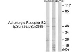 Western blot analysis of extracts from HuvEc cells treated with serum 20% 15' and COS7 cells treated with serum 20% 15', using Adrenergic Receptor B2 (Phospho-Ser355+Ser356) Antibody.