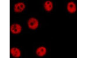 ABIN6274357 staining HepG2 cells by IF/ICC. (ZNF638 抗体  (Internal Region))