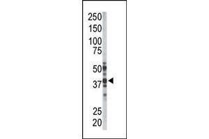 Image no. 1 for anti-Palmitoyl-Protein Thioesterase 1 (PPT1) (N-Term) antibody (ABIN357783) (PPT1 抗体  (N-Term))