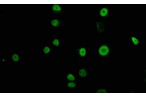 Immunofluorescence (IF) image for anti-Transcription Factor AP-2 gamma (Activating Enhancer Binding Protein 2 Gamma) (TFAP2C) (AA 8-180) antibody (ABIN7172475)
