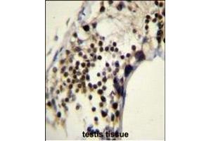 Immunohistochemistry (Paraffin-embedded Sections) (IHC (p)) image for anti-Rac GTPase Activating Protein 1 (RACGAP1) (AA 23-50), (N-Term) antibody (ABIN655408)