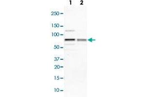 Western blot analysis of Lane 1: NIH-3T3 cell lysate (Mouse embryonic fibroblast cells); Lane 2: NBT-II cell lysate (Rat Wistar bladder tumour cells) with IGF2BP3 polyclonal antibody  at 1:100-1:250 dilution. (IGF2BP3 抗体)