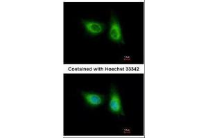 ICC/IF Image Immunofluorescence analysis of methanol-fixed A549, using SOS2, antibody at 1:500 dilution. (SOS2 抗体  (Center))