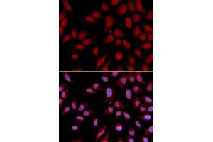 Immunofluorescence analysis of U2OS cell using DLGAP5 antibody. (DLGAP5 抗体)