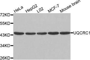 Western blot analysis of extracts of various cell lines, using UQCRC1 antibody. (UQCRC1 抗体  (AA 156-480))