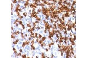 Formalin-fixed, paraffin-embedded human tonsil stained with CD44 antibody (HCM15-1)