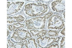 IHC analysis of NRF1 using anti-NRF1 antibody (ABIN7600874).