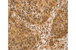 Immunohistochemistry (IHC) image for anti-Vacuole Membrane Protein 1 (VMP1) antibody (ABIN2427419) (VMP1 抗体)