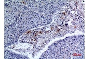 Immunohistochemistry (IHC) analysis of paraffin-embedded Human Lung, antibody was diluted at 1:100. (IREM1 抗体  (Internal Region))