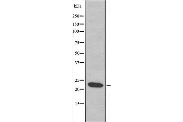MRPL21 抗体  (Internal Region)