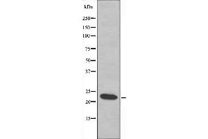 Western blot analysis of extracts from COLO cells, using MRPL21 antibody. (MRPL21 抗体  (Internal Region))