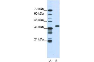 WB Suggested Anti-PCBP1 Antibody Titration:  1. (PCBP1 抗体  (Middle Region))