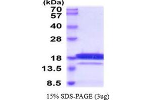 SDS-PAGE (SDS) image for Retinoic Acid Receptor Responder (Tazarotene Induced) 2 (RARRES2) (AA 21-157) protein (His tag) (ABIN6387949)