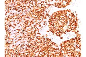 Immunohistochemistry (IHC) image for anti-Protein tyrosine Phosphatase, Receptor Type, C (PTPRC) antibody (ABIN6940452)