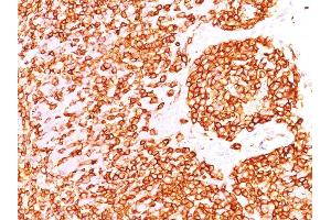 Formalin-fixed, paraffin-embedded human Tonsil stained with CD45 Mouse Recombinant Monoclonal Antibody (rPTPRC/1460). (Recombinant CD45 抗体)