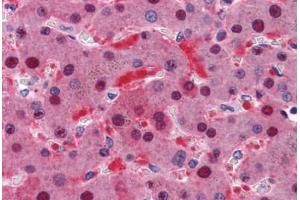 Human Liver: Formalin-Fixed, Paraffin-Embedded (FFPE) (TTC1 抗体  (AA 193-293))