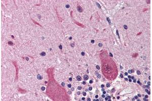 Human Brain, Cerebellum (formalin-fixed, paraffin-embedded) stained with RRM2B antibody ABIN214469 at 2. (RRM2B 抗体  (AA 2-17))