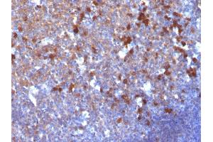 Formalin-fixed, paraffin-embedded human Tonsil stained with IgG Monoclonal Antibody (IG217) (IGHG 抗体)