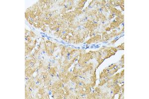 Immunohistochemistry of paraffin-embedded mouse heart using TP53I11 antibody (ABIN6131365, ABIN6149418, ABIN6149419 and ABIN6216636) at dilution of 1:100 (40x lens). (TP53I11 抗体  (AA 1-70))