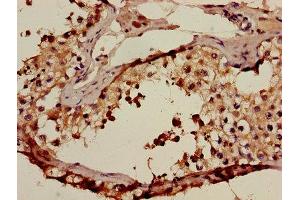 Immunohistochemistry of paraffin-embedded human testis tissue using ABIN7143025 at dilution of 1:100 (ACRV1 抗体  (AA 22-265))