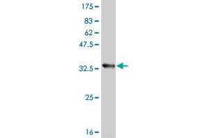 Western Blot detection against Immunogen (33. (ATOX1 抗体  (AA 1-68))