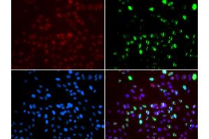 Immunofluorescence analysis of GFP-RNF168 transgenic U2OS cells using MSH6 antibody (ABIN5971626). (MSH6 抗体)
