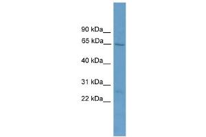 WB Suggested Anti-ACOT11  Antibody Titration: 0. (ACOT11 抗体  (Middle Region))