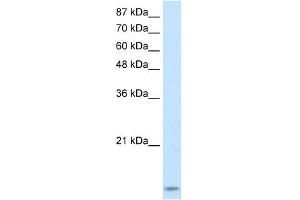 TARBP2 antibody used at 2. (TARBP2 抗体)