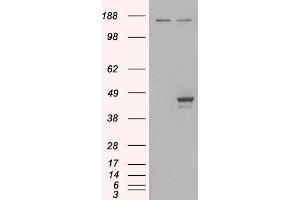 Western Blotting (WB) image for anti-E74-Like Factor 3 (Ets Domain Transcription Factor, Epithelial-Specific) (ELF3) (C-Term) antibody (ABIN184777)