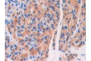 Detection of F5 in Mouse Ovary Tissue using Polyclonal Antibody to Coagulation Factor V (F5) (Coagulation Factor V 抗体  (AA 364-611))