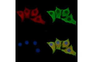 ABIN7096169 and ABIN7100231 staining HepG2 cells by IF/ICC.