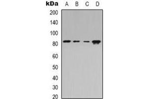 Western blot analysis of Beta-adducin expression in Jurkat (A), HEK293T (B), Raw264. (ADD2 抗体)