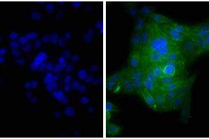 Human epithelial carcinoma cell line HEp-2 was stained with Mouse Anti-Human CD44-UNLB and DAPI. (山羊 anti-小鼠 Ig Antibody (FITC) - Preadsorbed)