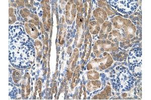 FAM55D antibody was used for immunohistochemistry at a concentration of 4-8 ug/ml to stain Epithelial cells of renal tubule (arrows) in Human Kidney. (FAM55D 抗体  (C-Term))