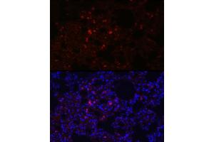 Immunofluorescence analysis of rat lung using SFTPC Rabbit pAb (ABIN3015597, ABIN3015598, ABIN3015599, ABIN1682683 and ABIN6218961) at dilution of 1:100 (40x lens).