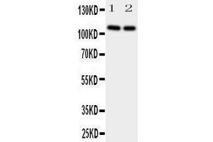 Western Blotting (WB) image for anti-Neuropilin 2 (NRP2) (AA 45-60), (N-Term) antibody (ABIN3044160) (NRP2 抗体  (N-Term))