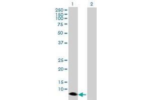 Western Blotting (WB) image for PTGES 293T Cell Transient Overexpression Lysate(Denatured) (ABIN1334590)
