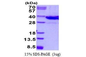 Lectin, Galactoside-Binding, Soluble, 8 (LGALS8) (AA 1-316) (Active) protein (His tag)