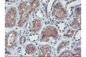 Image no. 1 for anti-Regulatory Factor X-Associated Ankyrin Containing Protein (RFXANK) antibody (ABIN1500685) (RFXANK 抗体)