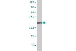 Western Blot detection against Immunogen (36. (HSF4 抗体  (AA 121-220))