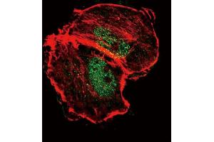 Confocal immunofluorescent analysis of Phospho-TSC2-p Antibody (ABIN389817 and ABIN2839703) with MCF-7 cell followed by Alexa Fluor 488-conjugated goat anti-rabbit lgG (green). (Tuberin 抗体  (pSer664))