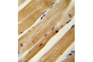 Immunohistochemistry analysis in formalin fixed and paraffin embedded human skeletal muscle reacted with MLXIP Antibody (N-term) followed by peroxidase conjugation of the secondary antibody and DAB staining.