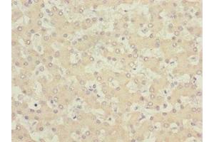 Immunohistochemistry of paraffin-embedded human liver tissue using ABIN7153515 at dilution of 1:100 (GABARAPL1 抗体  (AA 1-117))