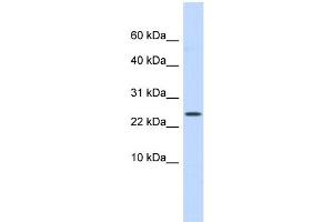 WB Suggested Anti-LYPD6 Antibody Titration: 0. (LYPD6 抗体  (Middle Region))