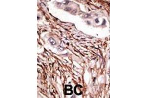 Immunohistochemistry (IHC) image for anti-Notch 3 (NOTCH3) antibody (ABIN3002554) (NOTCH3 抗体)