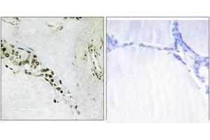 Immunohistochemistry analysis of paraffin-embedded human thyroid gland tissue, using Cyclin E2 (Ab-392) Antibody. (Cyclin E2 抗体  (AA 355-404))