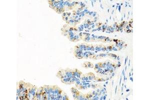 Immunohistochemistry of paraffin-embedded Mouse lung using RGS5 Polyclonal Antibody at dilution of 1:100 (40x lens). (RGS5 抗体)