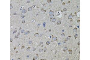 Immunohistochemistry of paraffin-embedded Rat brain using CKAP4 Polyclonal Antibody (CKAP4 抗体)